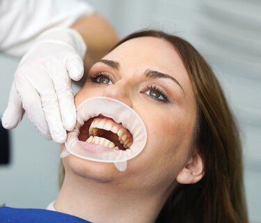 Wandhaken & Mondspreiders